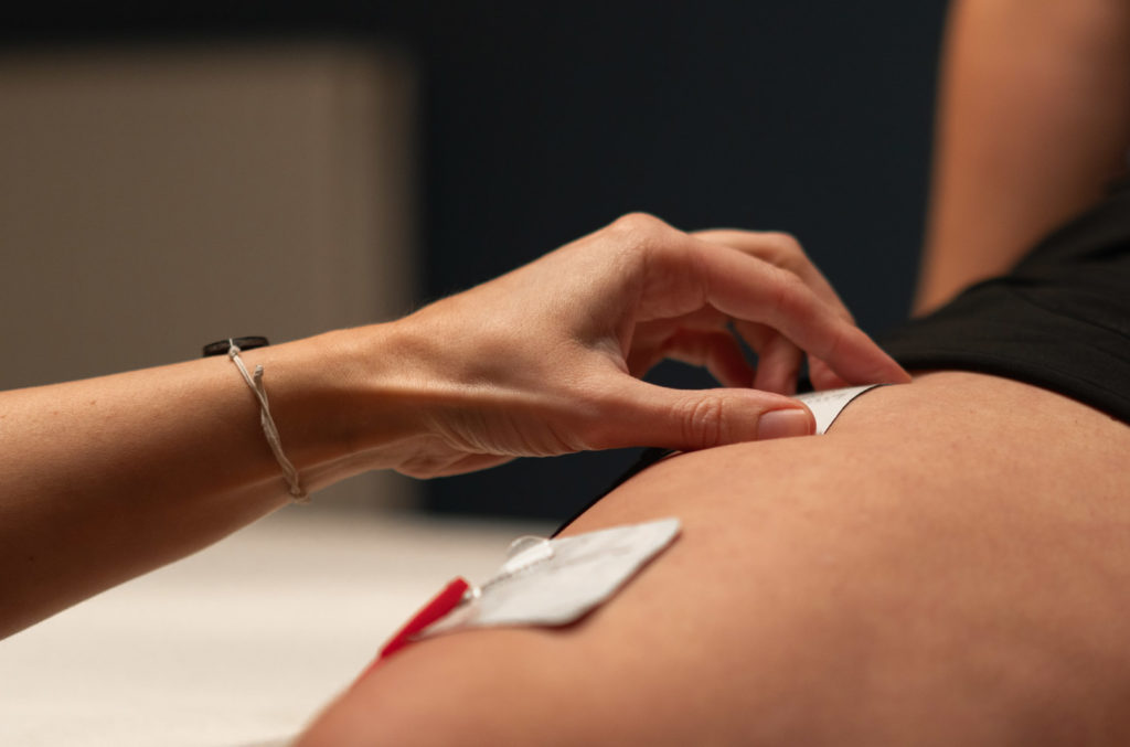 Eine Hand befestigt Elektroden auf dem Oberschenkel einer sitzenden Person auf einer Behandlungsliege.