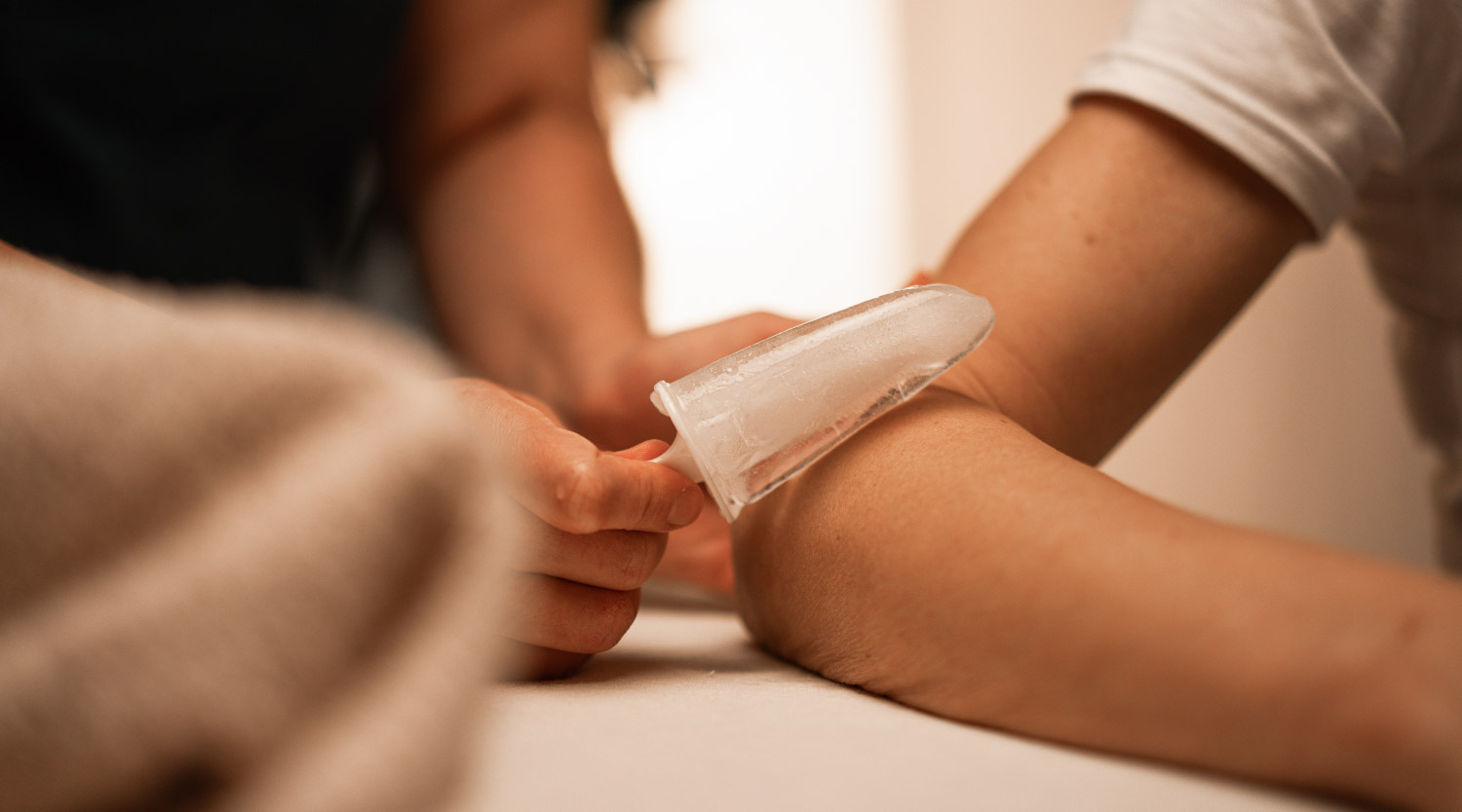 Eine Person hält eine Stange Eis an den Knöchel einer liegenden Person, während der Fuß auf einer Behandlungsliege ruht.